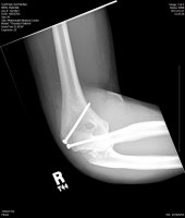 1.2.840.113619.2.203.4.2147483647.1358790154.358031.jpg 1.2.840.113619.2.203.4.2147483647.1358790154.358031.jpg