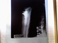 Right Shoulder 2013.jpg Right Shoulder 2013.jpg