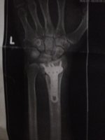 20150106_150444.jpg 20150106_150444.jpg