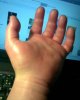 hand hurt.jpg hand hurt.jpg