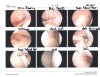 Shoulder-Arthroscopy_1.jpg Shoulder-Arthroscopy_1.jpg