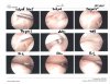 Shoulder-Arthroscopy_2.jpg Shoulder-Arthroscopy_2.jpg