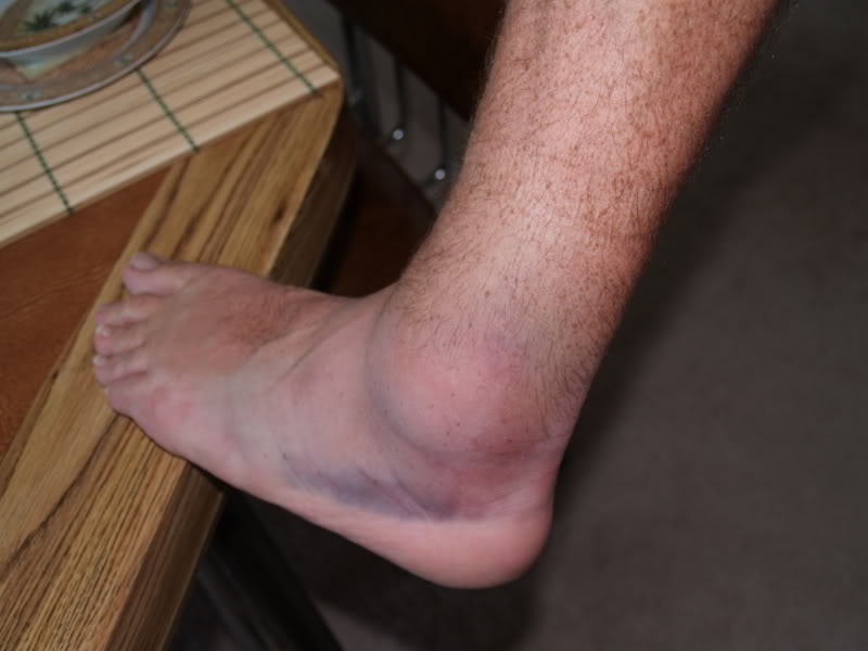 injurypics003.jpg